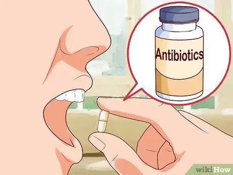 Image titled Relieve Discomfort Caused by Eczema Step 16