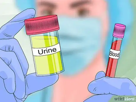 Image titled Treat Encephalitozoonosis in Dogs Step 3