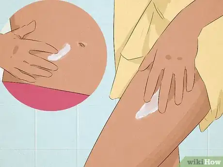 Image titled Prevent Stretch Marks During Puberty Step 7