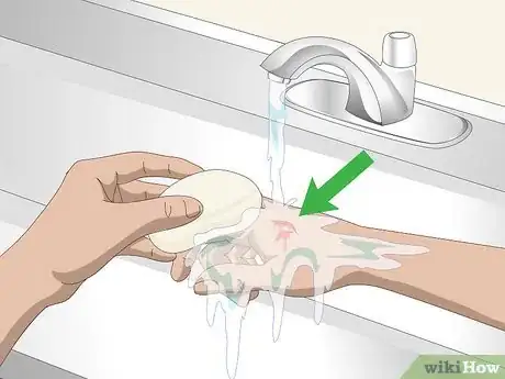 Image titled Treat and Prevent Macaw Bites Step 1