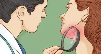 Treat Sunburn with Natural Remedies