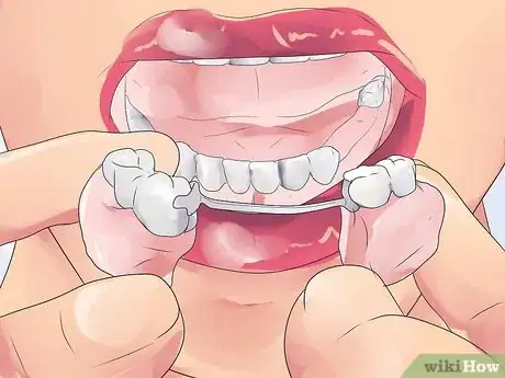 Image titled Handle Tooth Loss Step 2