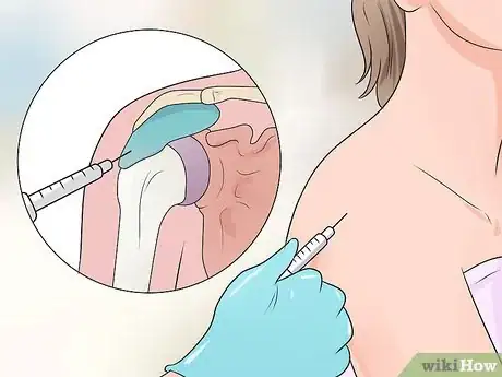 Image titled Alleviate Tendonitis Step 27