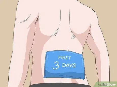 Image titled Treat Sciatica Naturally Step 1