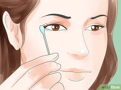 Image titled Treat Measles Step 5