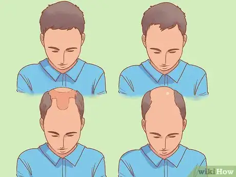 Image titled Stop Hormonal Hair Loss Step 9