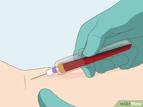 Image titled Find Out if You Have a Vitamin Deficiency Step 11