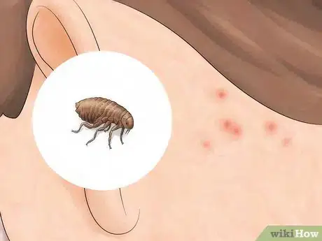 Image titled Identify Insect Bites Step 6