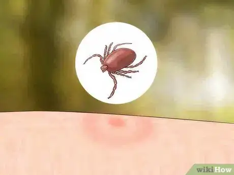 Image titled Identify Insect Bites Step 5