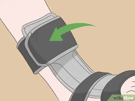 Image titled Wear a Dorsal Night Splint Step 4
