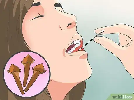 Image titled Get Rid of a Tooth Infection Step 10
