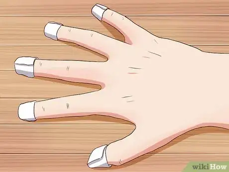 Image titled Stop Biting Your Fingers Step 2