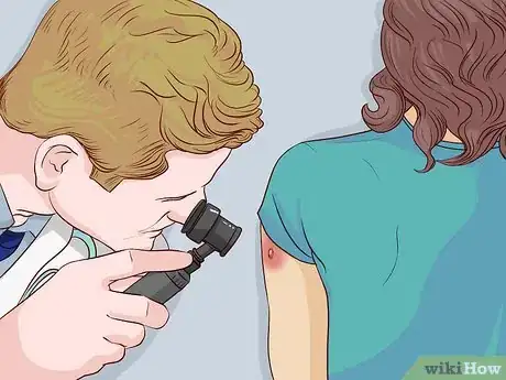 Image titled Treat Sunburn with Natural Remedies Step 10