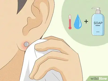 Image titled Treat Infected Piercings Step 8