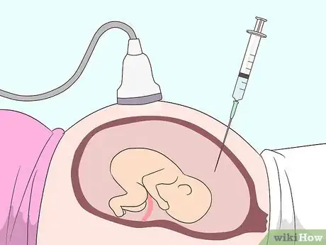 Image titled Get Tested for Zika Step 10