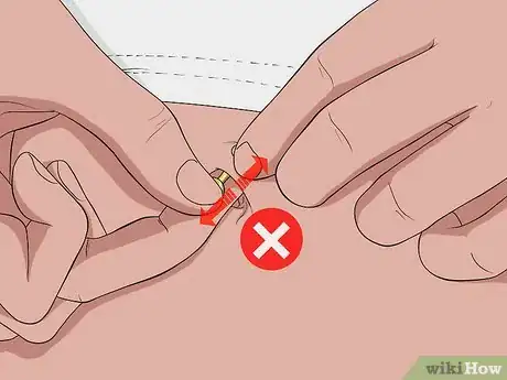 Image titled Treat an Irritated Belly Button Piercing Step 12