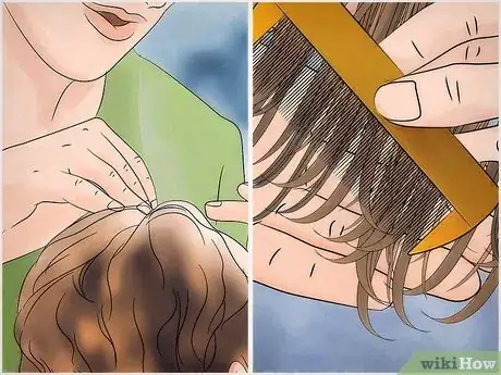 Image titled Free Your Child from Lice Step 23
