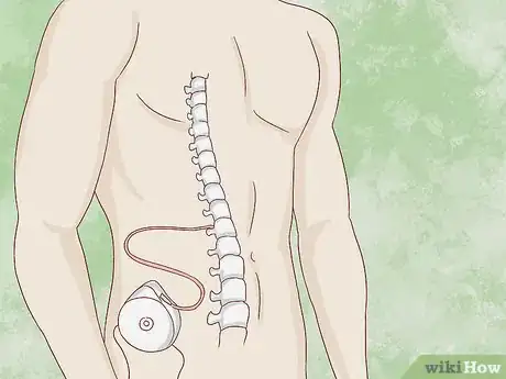 Image titled Deal with Spasticity Step 5