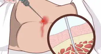 Diagnose Fanconi Anemia