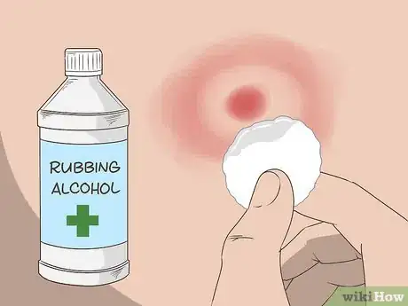 Image titled Prevent Lyme Disease Step 10