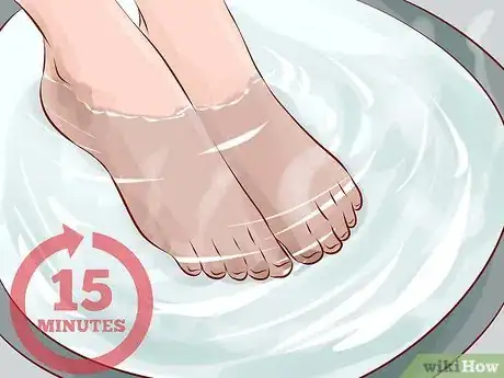 Image titled Treat Trench Foot Step 3