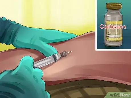 Image titled Treat Bone Spurs Step 11