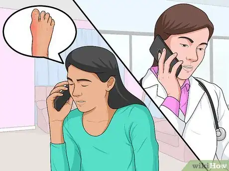 Image titled Treat Bunions Naturally Step 12