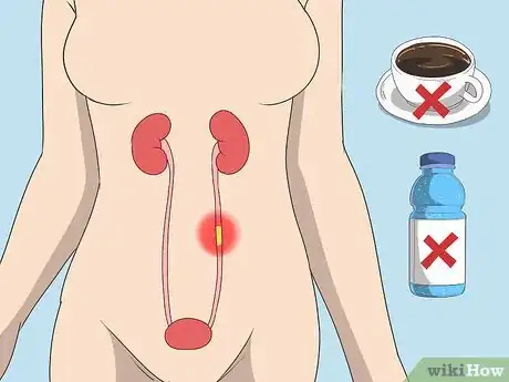 Image titled Avoid UTIs when You're Sexually Active Step 8