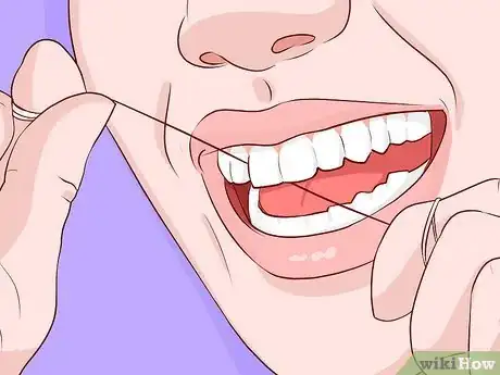 Image titled Get Rid of Plaque Naturally Step 4