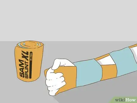 Image titled Apply Splints Step 8