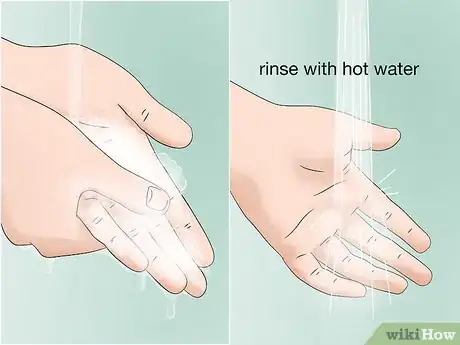 Image titled Treat a Lionfish Sting Step 15