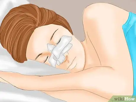 Image titled Prevent Bruising After Plastic Surgery Step 11