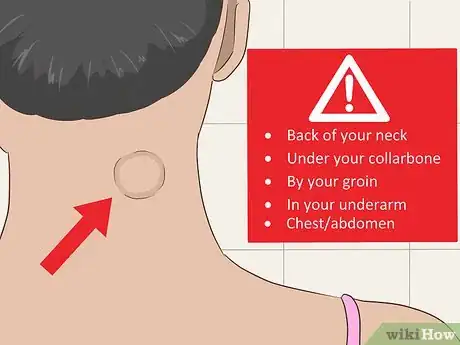 Image titled Diagnose Castleman Disease Step 1