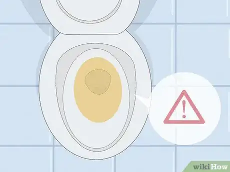 Image titled Protect Your Liver Step 11