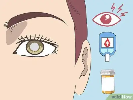 Image titled Treat Cataracts Step 14