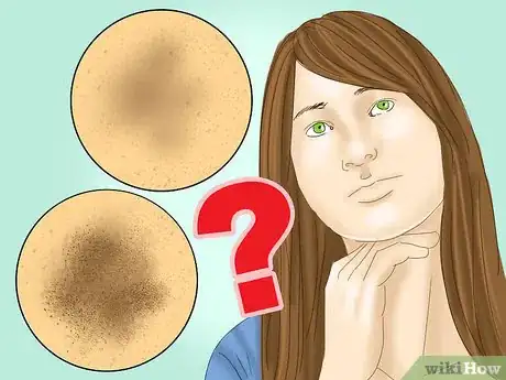 Image titled Prevent Hyperpigmentation of the Skin Step 1