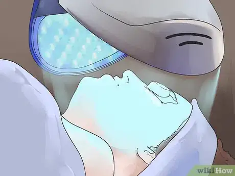 Image titled Treat Acne with Light Therapy Step 3