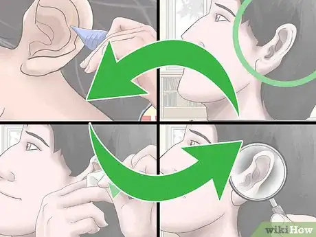 Image titled Wax Ear Hairs Step 11