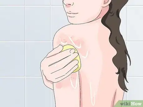 Image titled Prevent Milia Step 3