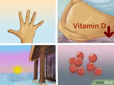 Image titled Treat Rickets Step 8