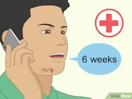 Image titled Prevent Cystic Acne Step 9