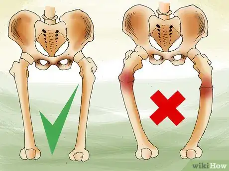 Image titled Supplement Vitamin D in Babies Step 7.jpeg