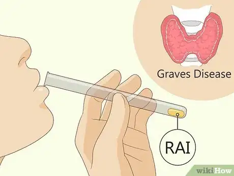 Image titled Prevent and Treat a Thyroid Storm Step 2