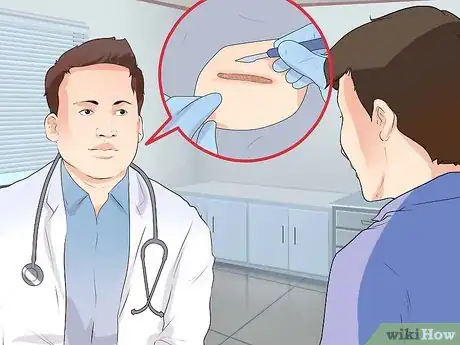 Image titled Prevent Keloid and Hypertrophic Scars Step 11