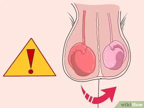 Image titled Know if You Have Epididymitis Step 1