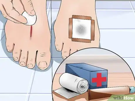 Image titled Care for a Cut Step 6