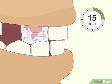 Image titled Pull a Loose Tooth at Home Step 10