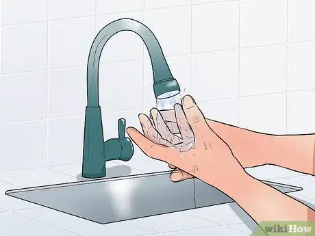 Image titled Care for a Cut Step 1