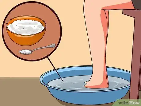 Image titled Soothe Sore Feet Step 19