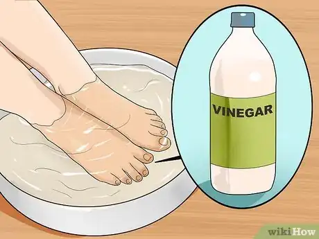 Image titled Get Rid of Yellow Toenails Step 12